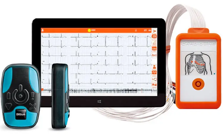 ecg